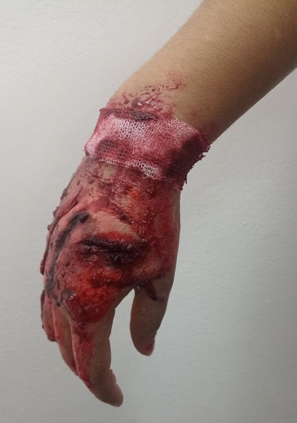 Heridas. Fx