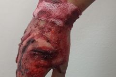 Heridas. Fx